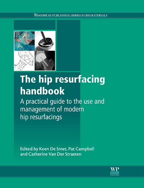 The Hip Resurfacing Handbook: A Practical Guide to the Use and Management of Modern Hip Resurfacings