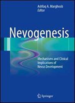 Nevogenesis: Mechanisms And Clinical Implications Of Nevus Development