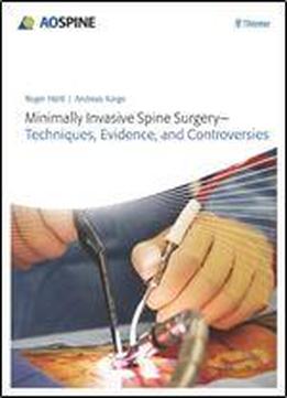 Minimally Invasive Spine Surgery: Techniques, Evidence, And Controversies