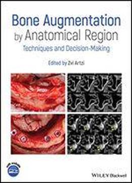 Bone Augmentation By Anatomical Region: Techniques And Decision-making